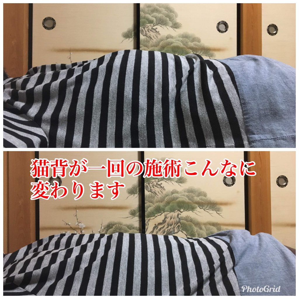 歩行困難の原因は骨盤の歪みだった